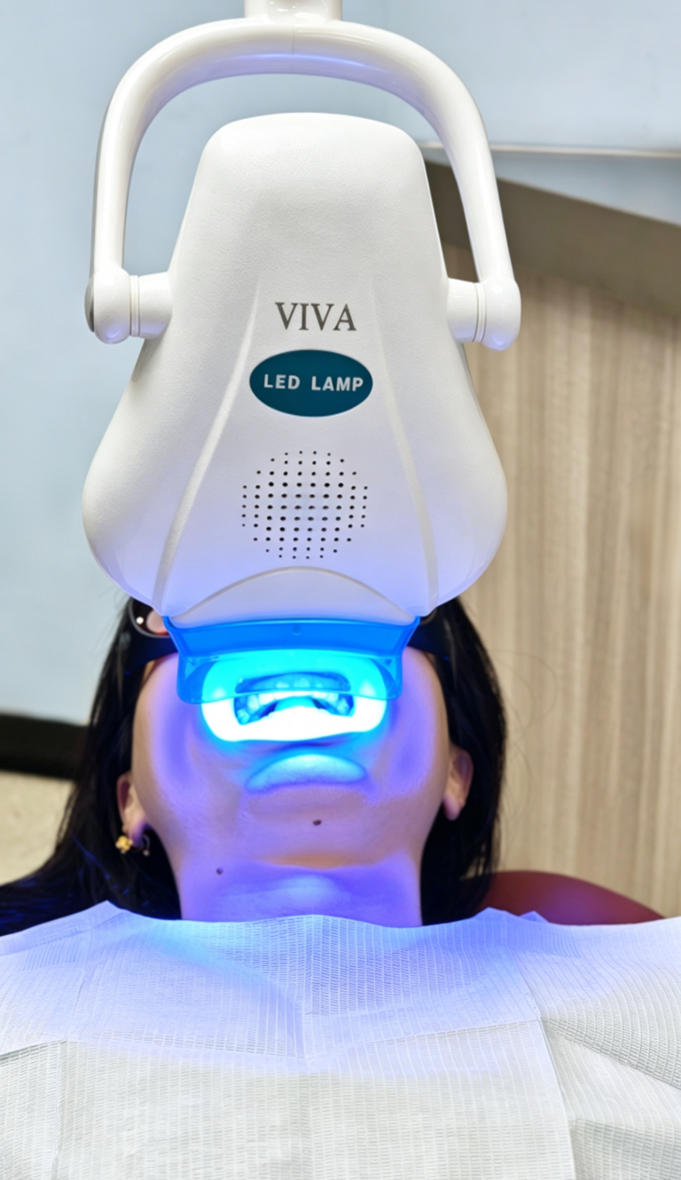 冷光美白仪，VIVA Y-M1-B1，曼奇奥口腔设备